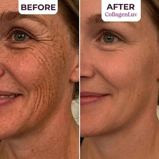 CollagenLuv™ Collagen Silicone Tape