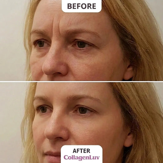 CollagenLuv™ Collagen Silicone Tape