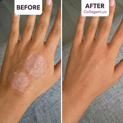 CollagenLuv™ Collagen Silicone Tape