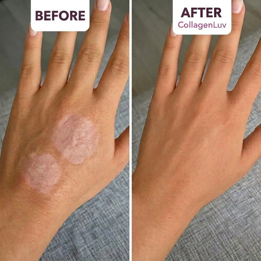 CollagenLuv™ Collagen Silicone Tape