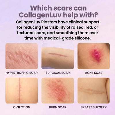 CollagenLuv™ Collagen Silicone Tape