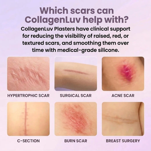 CollagenLuv™ Collagen Silicone Tape